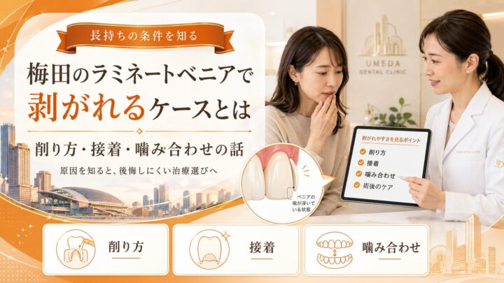 梅田のラミネートベニアで剥がれるケースとは｜削り方・接着・噛み合わせの話