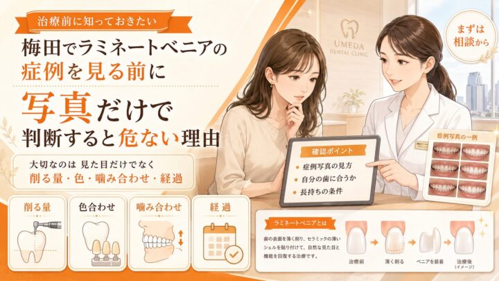 梅田でラミネートベニアの症例を見る前に｜写真だけで判断すると危ない理由