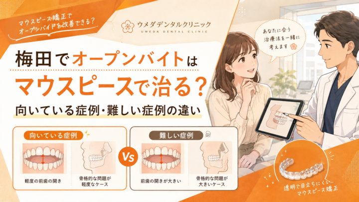 梅田でオープンバイトはマウスピースで治る？向いている症例・難しい症例の違い