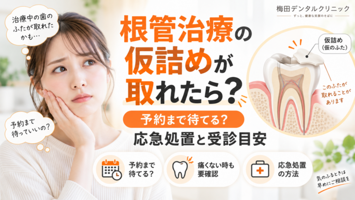根管治療の仮詰めが取れたら？次の予約まで待てる？応急処置と受診目安