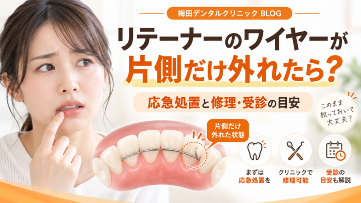 リテーナーのワイヤーが片側だけ外れたら？応急処置と修理・受診の目安
