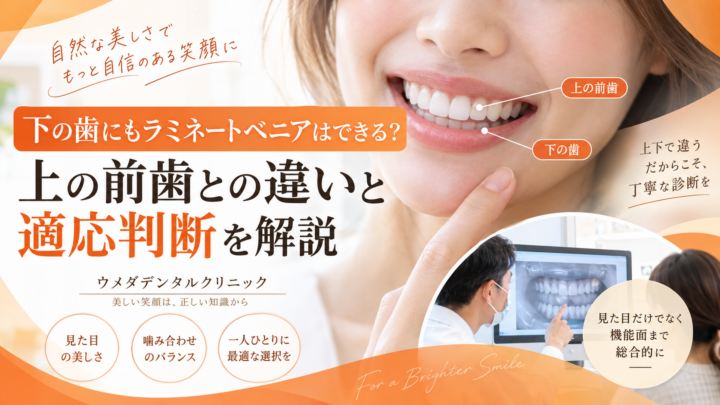 下の歯にもラミネートベニアはできる？上の前歯との違いと適応判断を解説