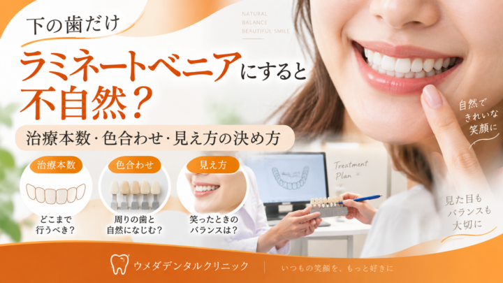 下の歯だけラミネートベニアにすると不自然？治療本数・色合わせ・見え方の決め方