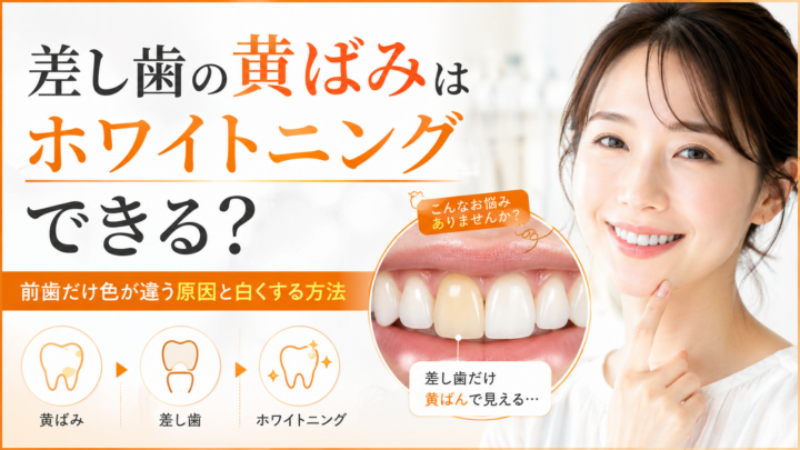 セラミックの歯ぐきが黒いのはなぜ？黒い線・ブラックマージンの原因と治し方