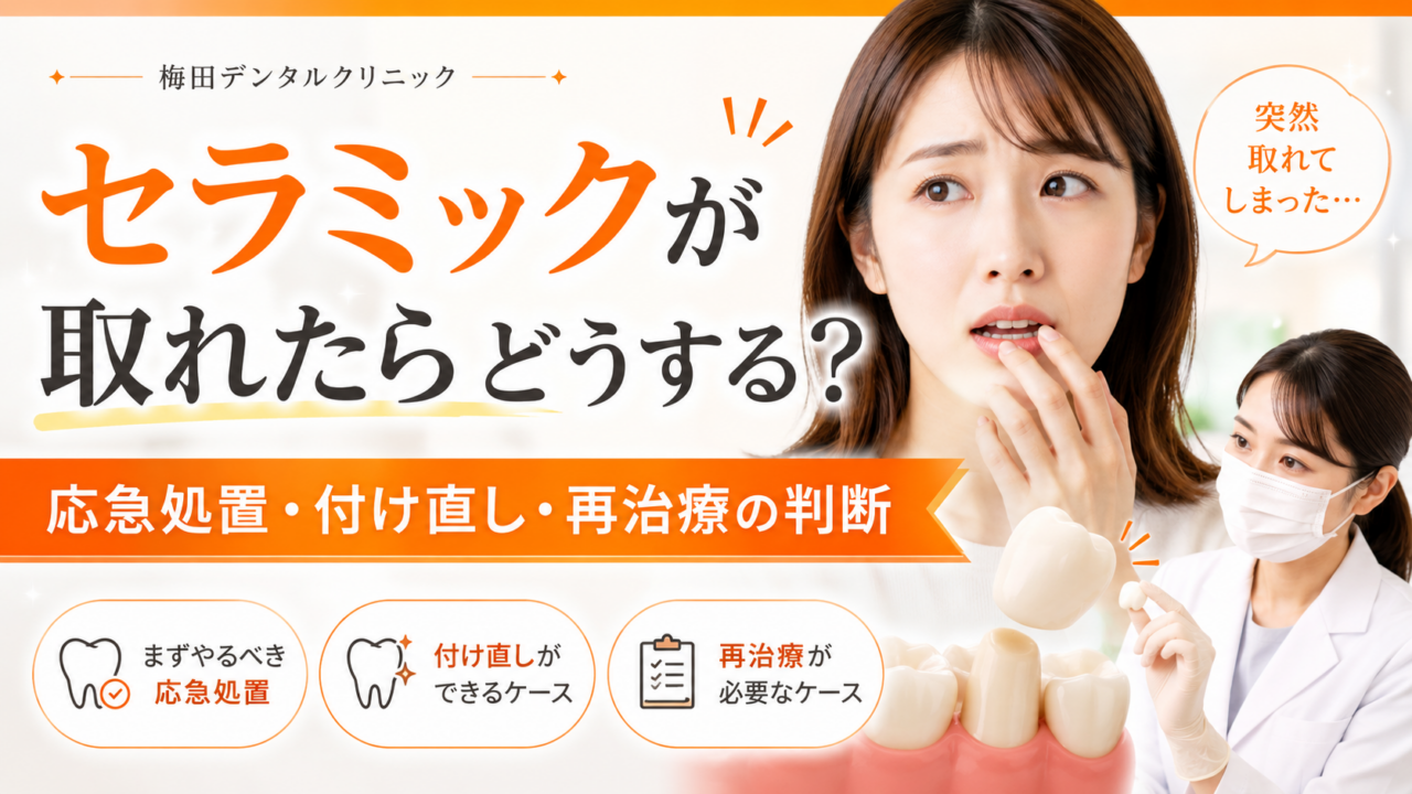 セラミックが取れた・外れたらどうする?応急処置・付け直せるケースと再治療の判断