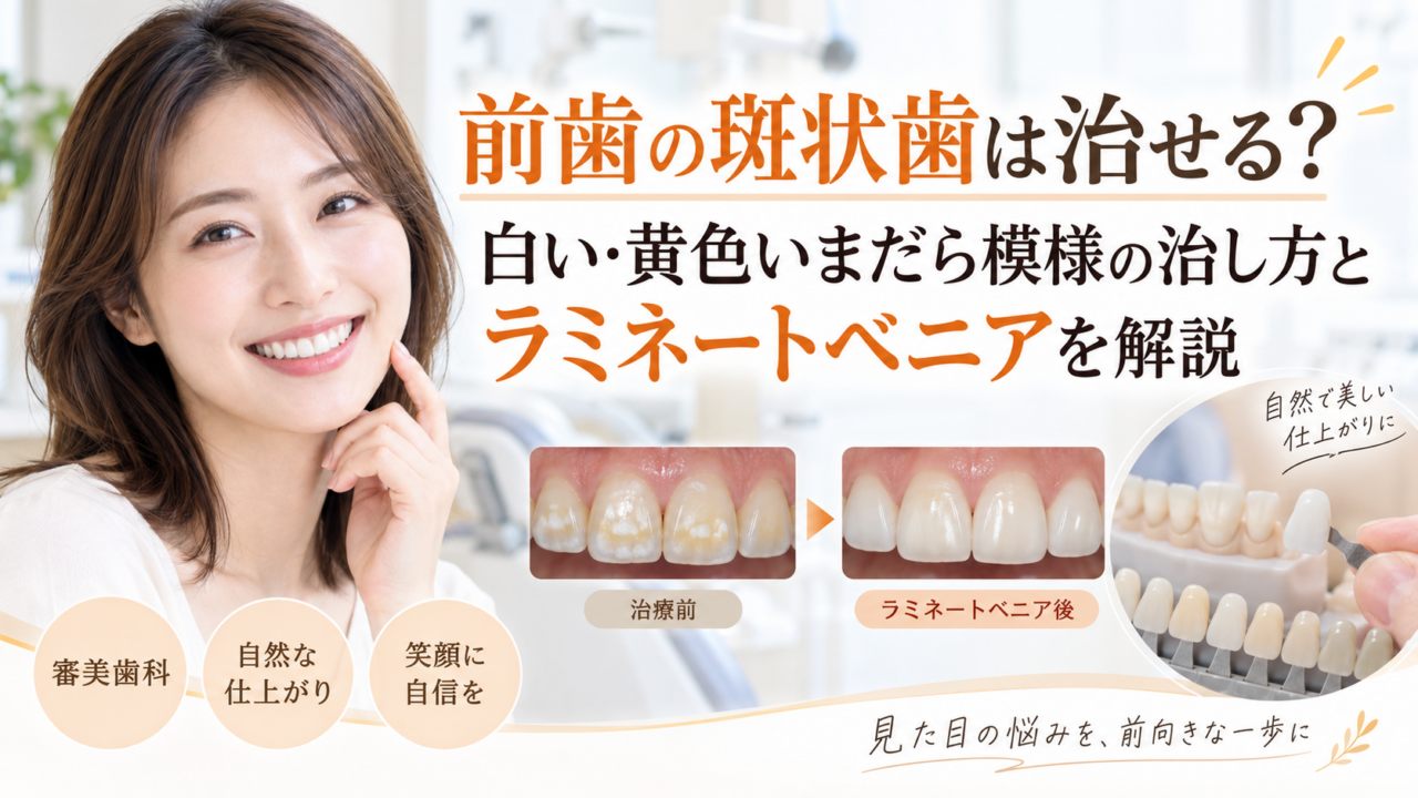前歯の斑状歯は治せる？白い・黄色いまだら模様の治し方とラミネートベニアを解説