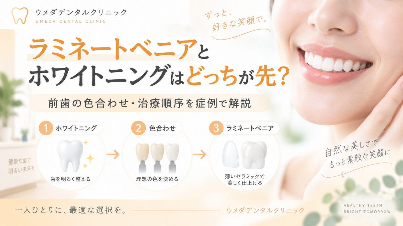 ラミネートベニアとホワイトニングはどっちが先?前歯の色合わせ・治療順序を症例で解説