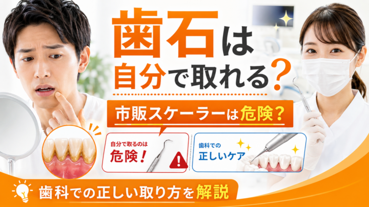 歯石は自分で取れる？市販スケーラーが危険な理由と歯科での正しい取り方