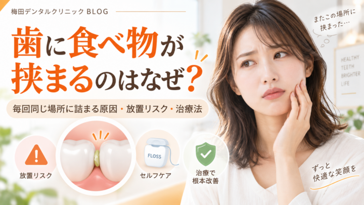 歯に食べ物が挟まるのはなぜ？毎回同じ場所に詰まる原因・放置リスク・治療法
