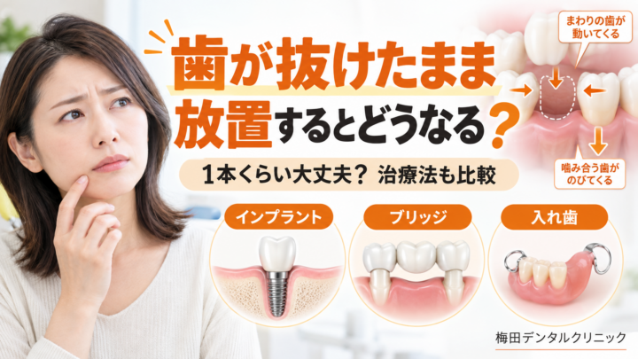 歯が抜けたまま放置するとどうなる？1本くらい大丈夫？インプラント・ブリッジ・入れ歯を比較