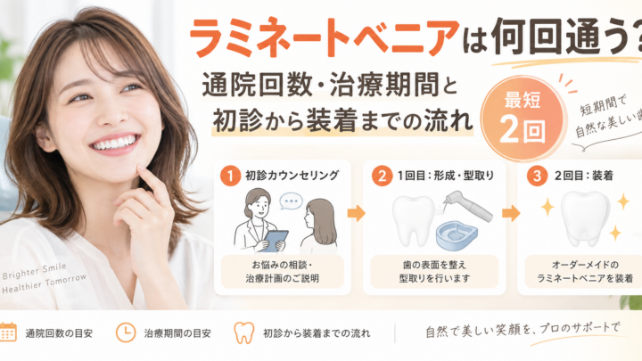 ラミネートベニアは何回通う？通院回数・治療期間と初診から装着までの流れ
