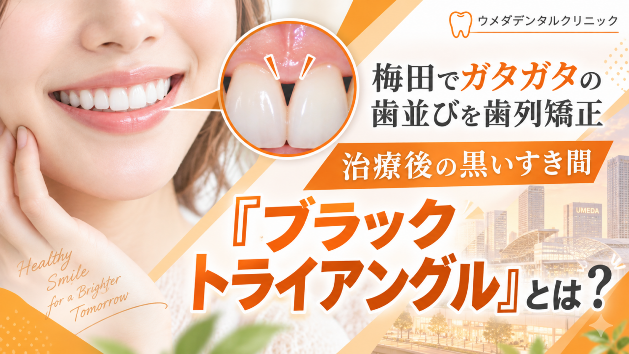 梅田でガタガタの歯並びを歯列矯正｜治療後の黒いすき間「ブラックトライアングル」とは？
