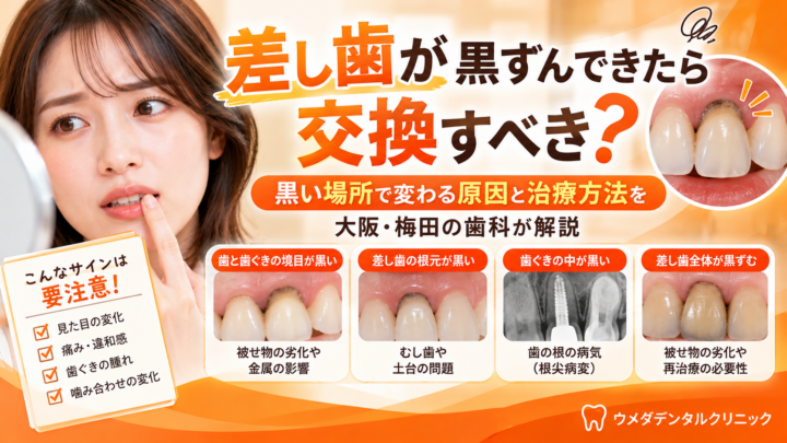 差し歯が黒ずんできたら交換すべき？黒い場所で変わる原因と治療方法を大阪・梅田の歯科が解説