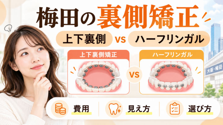 梅田で裏側矯正をするなら？ハーフリンガルとの違い・費用・後悔しない選び方